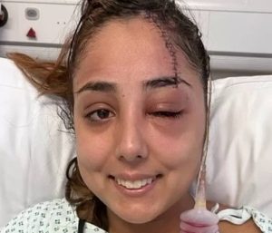 Accidente coche pinza pelo