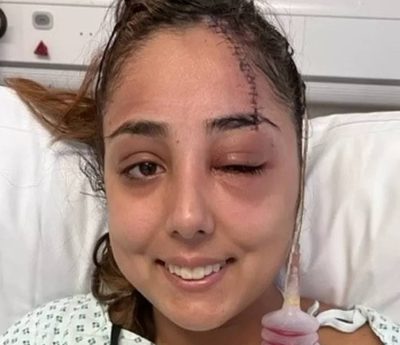 Accidente coche pinza pelo