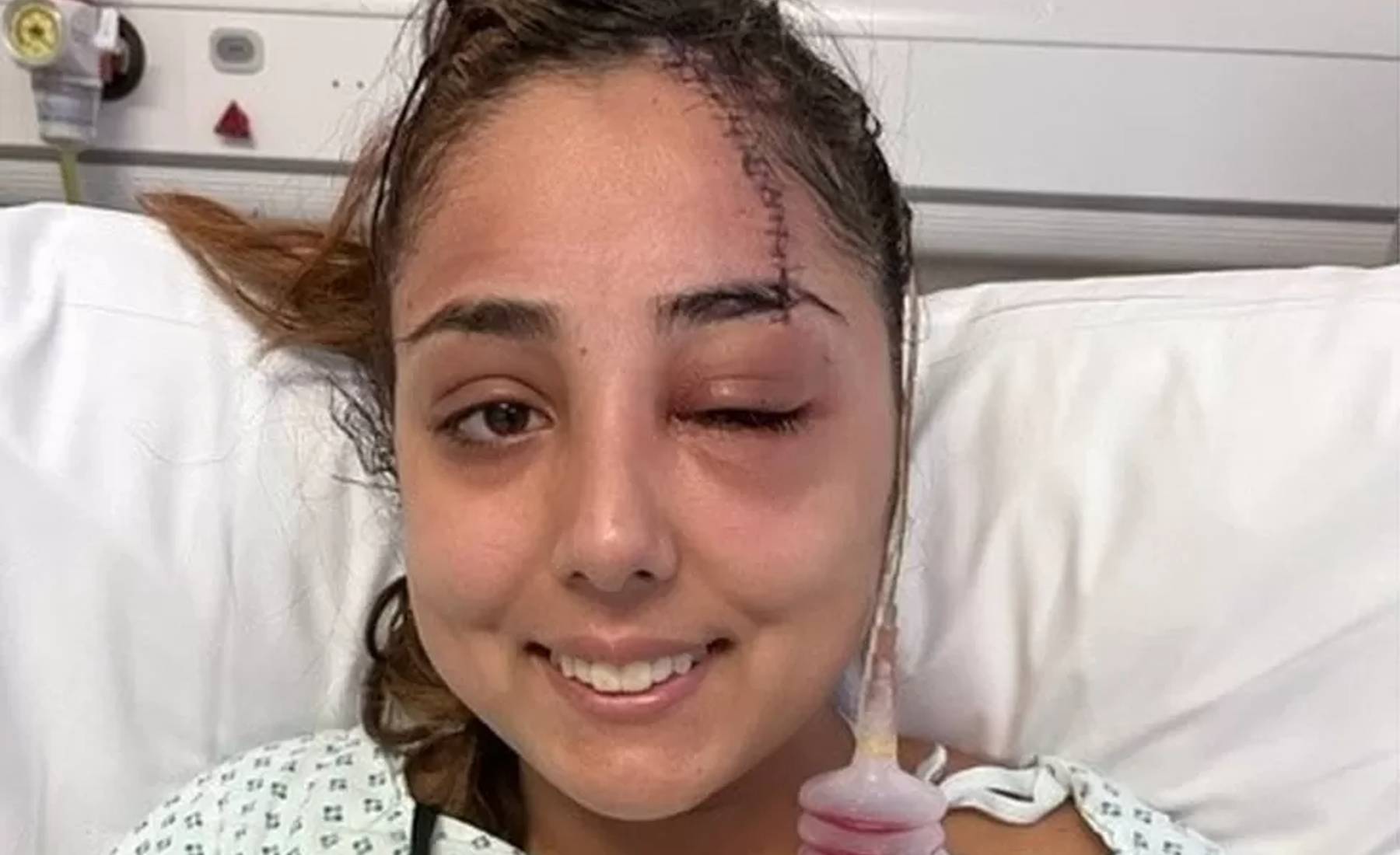 Accidente coche pinza pelo